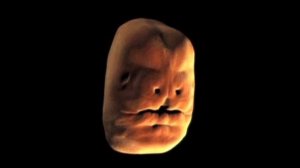 La formation du visage d'un bébé pendant la grossesse 480p