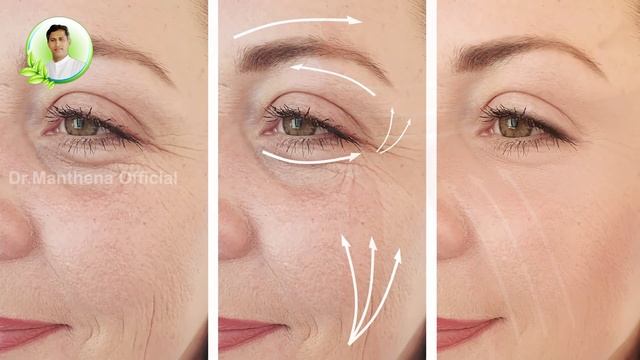 Benefits of Millets | Reduce Weight | Control Diabetes | Tightens Skin | Dr.Manthena's Health Tips смотреть онлайн