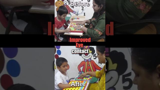 Regenerative Medicine Treatment for Improved Eye Contact in Autism смотреть онлайн