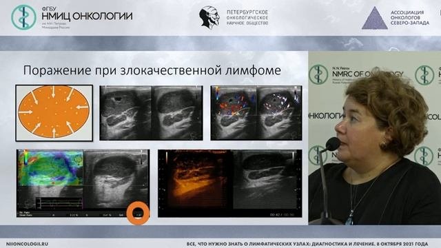 Мультипараметрическое УЗИ лимфатических узлов