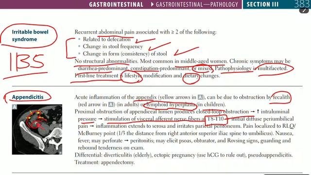 Up To Date - GIT PATHOLOGY (part 8) [ appendicitis & IBS ] смотреть онлайн