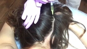 Мезотерапия, мастер класс сосудистый этап. Часть 1.