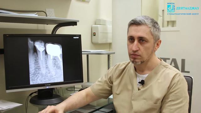 Вишняков А.А. Периодонтит (Клиника Дентал Джаз) смотреть онлайн