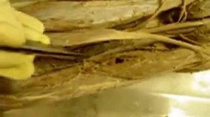 топографическая анатомия нижней конечности