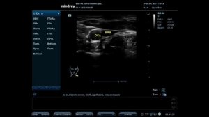 Основы ультразвуковой анатомии сосудов головы и шеи для студентов