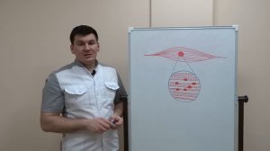 Триггерная точка. Причина болей в мышцах