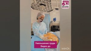 МОЙ ОПЕРАЦИОННЫЙ ДЕНЬ.
УМЕНЬШЕНИЕ ГРУДИ