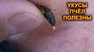 Укусы пчёл полезны.