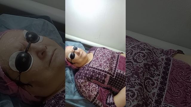 Элос омоложение смотреть онлайн видео от Косметолог_онлайн в хорошем ...