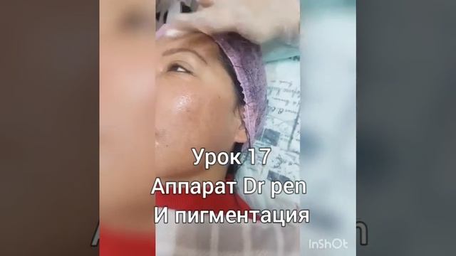 ПИГМЕНТАЦИЯ. ФРАНМЕНТ РАБОТЫ. kursy-krasoty.com смотреть онлайн