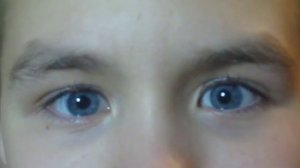 Дрожание глаз ,круто.