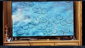 Александр Мишин. Исследование крови под темнопольным микроскопом. 13.07.2022.mp4