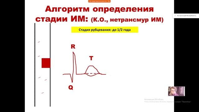 2 день школы ЭКГ #лекции #экг #инфарктмиокарда #диагностика