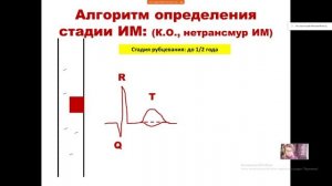 2 день школы ЭКГ #лекции #экг #инфарктмиокарда #диагностика