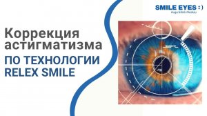 Лазерная коррекция астигматизма по технологии ReLEx SMILE