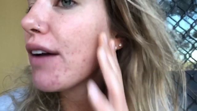 DOXYCYCLINE 4-12 weeks of treatment! Acne update! смотреть онлайн