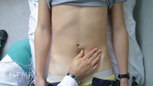 ПОВЕРХНОСТНАЯ ПАЛЬПАЦИЯ ПЕРЕДНЕЙ БРЮШНОЙ СТЕНКИ