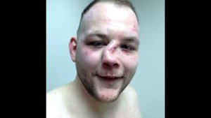 ТОП 5 САМЫХ УЖАСНЫХ ТРАВМ НОСА В ММА