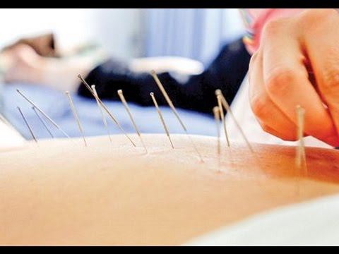 Здоровое детство. Зачем детям процедура иглорефлексотерапия? смотреть онлайн