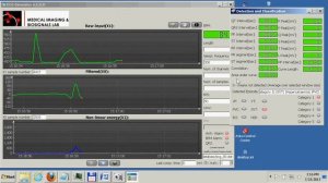 ecg 80 opened in last version 22 07 2013