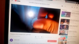 КАК УБРАТЬ ВОЗДУХ ИЗ-ПОД ЗАЩИТНОГО СТЕКЛА. НЕ ВОЗМОЖНО УБРАТЬ ВОЗДУХ ИЗ-ПОД ЗАЩИТНОГО СТЕКЛА.