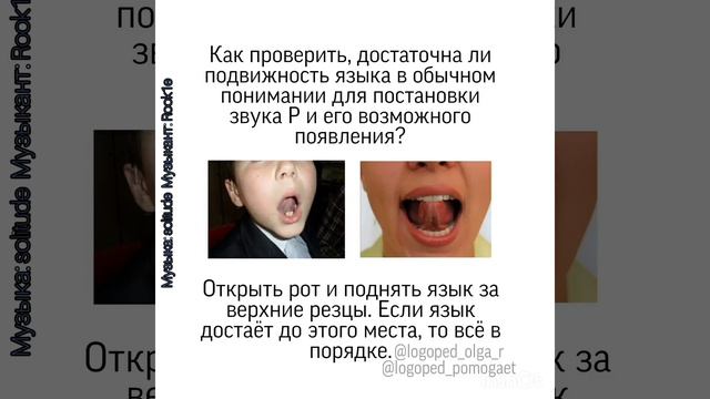 Подрезание подъязычной уздечки