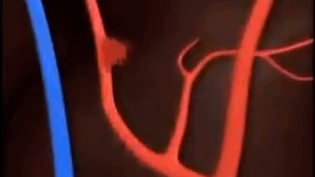 Edging my Brain AAUUGHeurysm смотреть онлайн