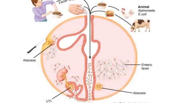 Enterobacteriaceae Salmonella Shigella E coli Gram negative rods смотреть онлайн