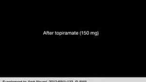 Topiramate Effect in Opsoclonus-Myoclonus-Ataxia Syndrome
