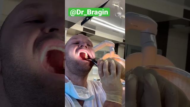 Удалить себе зуб мудрости смотреть онлайн