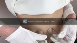 Аппарат вакуумно-роликового массажа NF-600 BL-600
