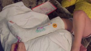 Рисуем на гипсе)продолжение)перелом ноги