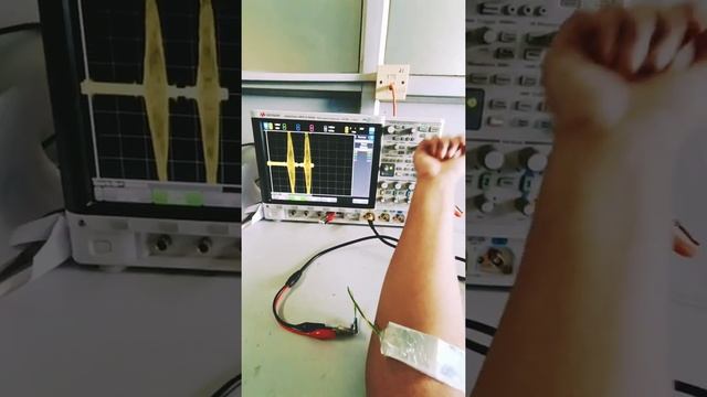 Human Motion Monitoring using paper based Triboelectric Nanogenerator (TENG)