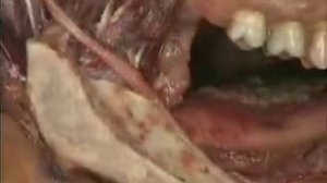 Анатомия человека. Нервы головы и шеи.