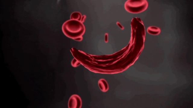 89% людей не Знают, Что ТВОРИТ Зелёный Чай, даже один глоток...