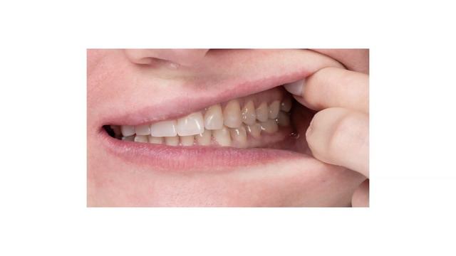 Как правильно делать фото для онлайн консультации смотреть онлайн