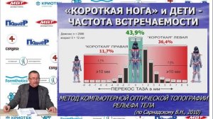 Владимир Нечаев. Синдром короткой ноги. Визуальная и мануальная диагностика
