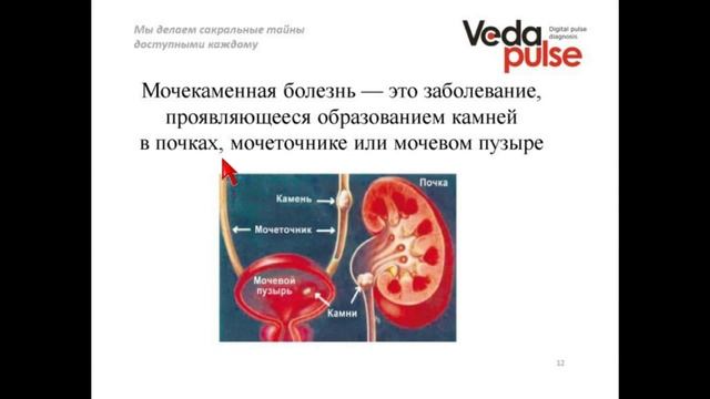 Пиелонефрит и мочекаменная болезнь (МКБ)