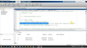 Region Growing. Segmentation by growing a region from seed point in Matlab