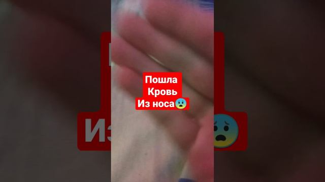 пошла кровь из носа 💉