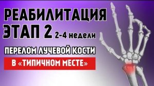 Перелом лучевой кости. Комплекс упражнений. Реабилитация ЭТАП 2 (2-4/6 неделя)