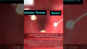 Аёл организмида фолликула етилиши ва овуляция жараёни