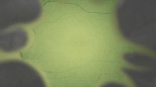 Неограниченные возможности или правда о Мозгоправе. Будни Мозгоправа #27 История незрячего психолог
