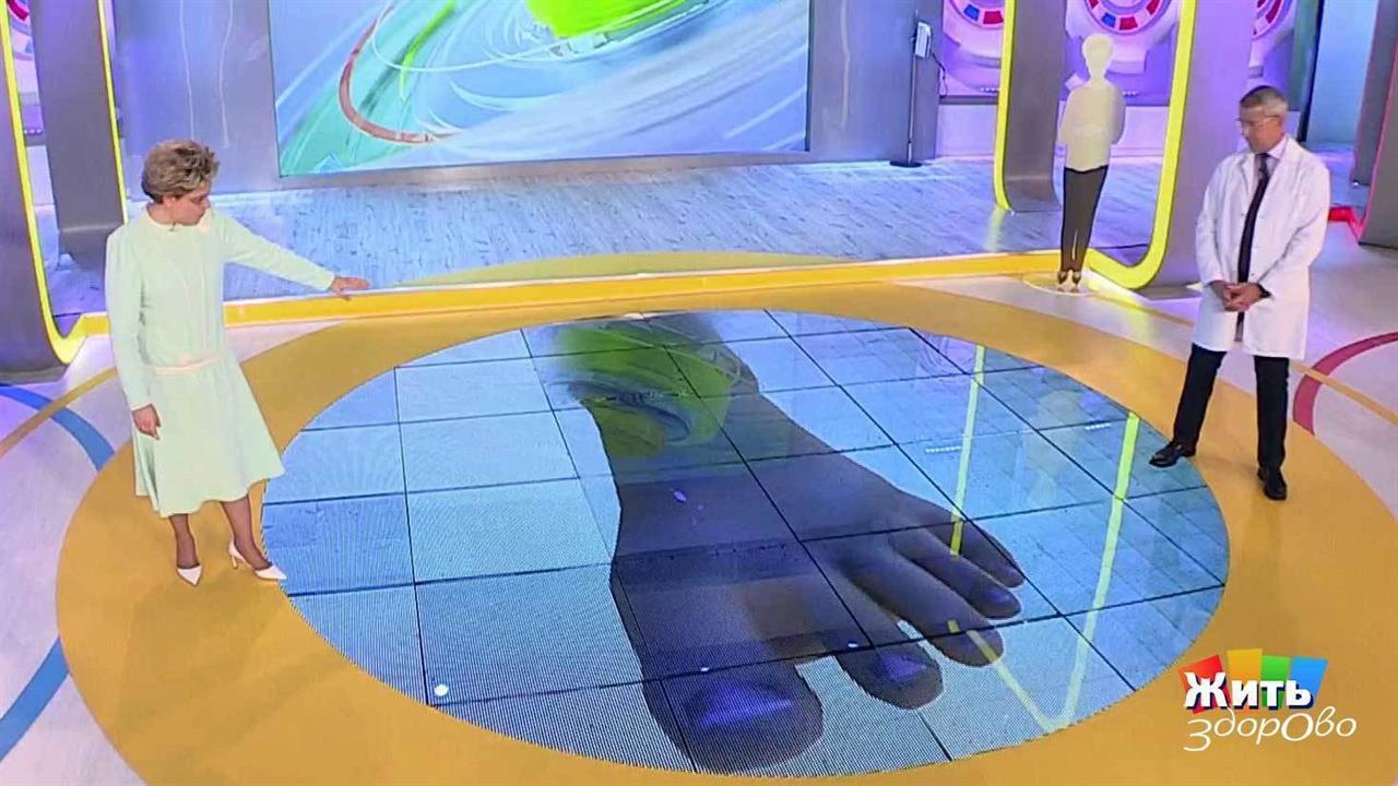 Жить здорово! Выпуск от 12.09.2017