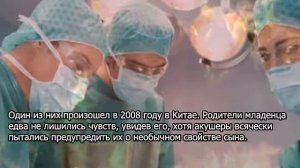 Мальчик с двумя половыми органами родился в Азербайджане