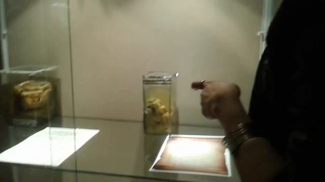 Кунсткамера Петра 1 (уроды,паразиты) смотреть онлайн