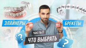 БРЕКЕТЫ или ЭЛАЙНЕРЫ? ЧАСТЬ1 #брекеты #элайнеры