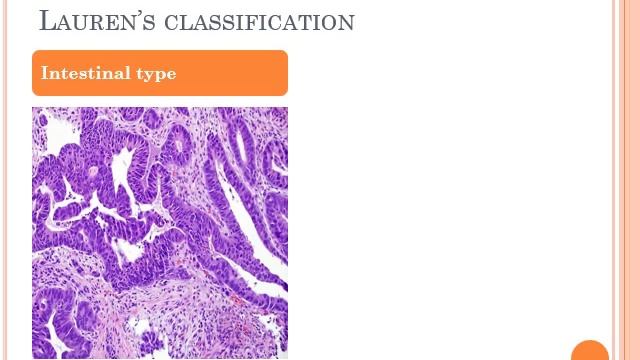 GIT 3: Gastric Carcinoma смотреть онлайн