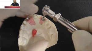 СТОМАТОЛОГИЧЕСКИЕ ИНСТРУМЕНТЫ ALIEXPRESS  Обзор динамометрического ключа для имплантологии