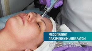 Мезопилинг методом Ablase